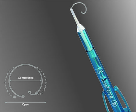 Pre-loaded CTR, Type 15, 10.0-12.3mm