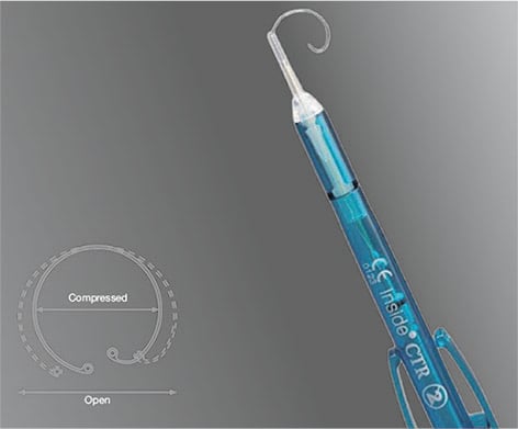 Preloaded CTR, Type 15A, 11.0 - 13.0mm