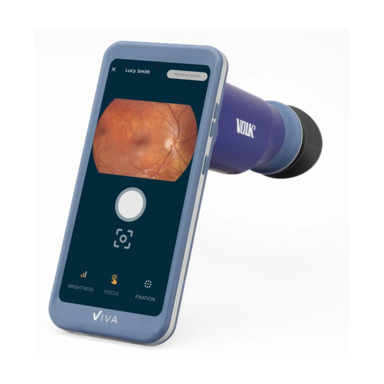 Volk Viva Non-Mydriatic Handheld Retinal Camera