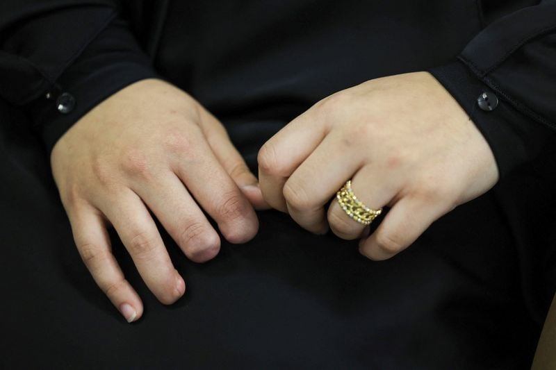 Image for A year on, Lebanese maimed in Israel's pager attacks on long road to recovery