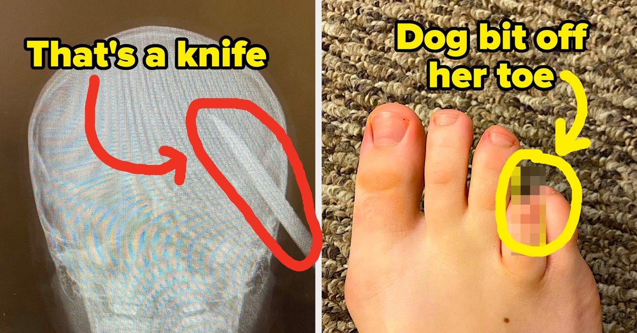 Buzzfeed image for 23 Healthcare Workers Are Sharing Their Most Baffling "HIPAA-Compliant" Patient Stories - BuzzFeed