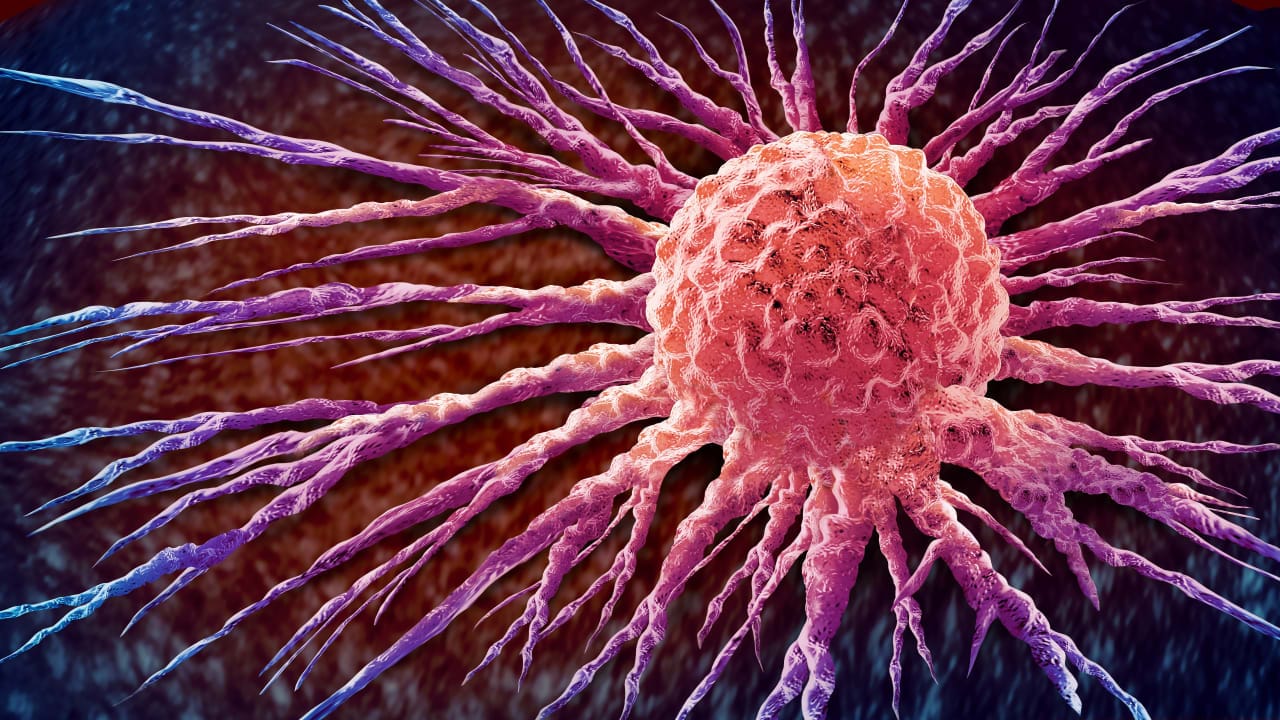 The Jerusalem Post image for New cancer shot dissolves whole tumors in patients - The Jerusalem Post