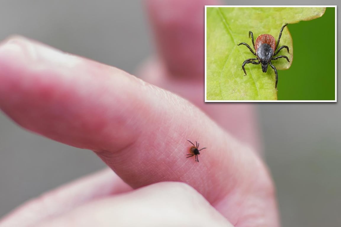 Fox News image for New tick-borne virus that can cause flu-like illness discovered in China - New York Post