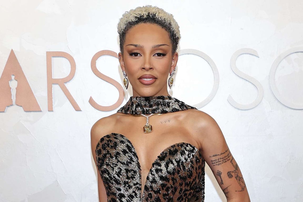 Entertainment Weekly image for Doja Cat reveals borderline personality disorder diagnosis, defends Chappell Roan: 'Let her have an attitude' - Entertainment Weekly