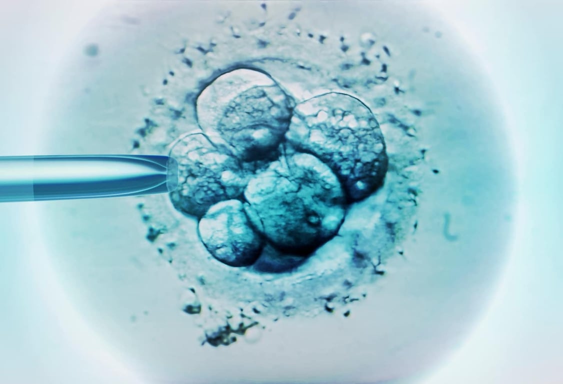 The Washington Post image for DNA editing of human embryos reignites debate over designer babies - The Washington Post