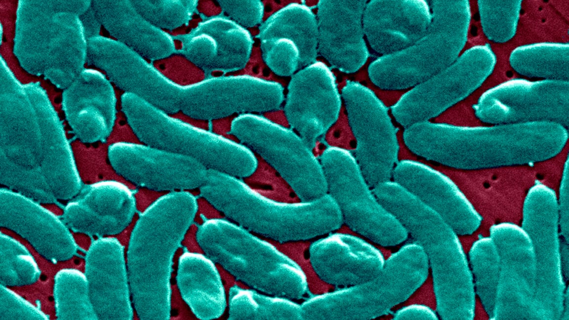 Ars Technica image for Flesh-eating bacteria devour man's arm and leg in just three days - Ars Technica