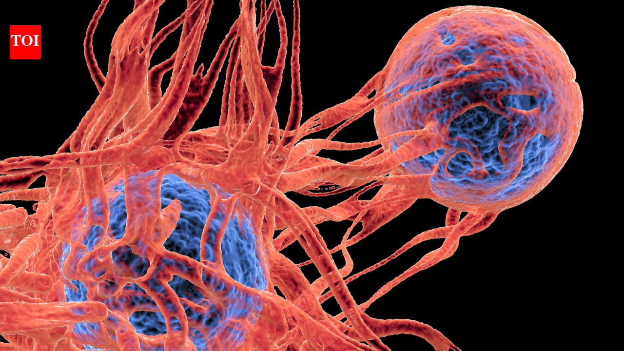 The Times of India image for Early cancer symptoms that often feel harmless: Warning signs people ignore and when to see a doctor - The Times of India