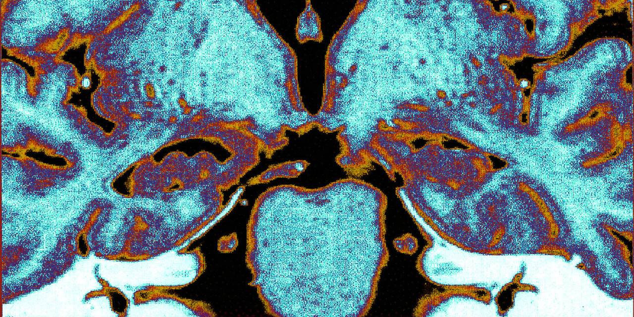 The Wall Street Journal image for Scientists Successfully Unfroze Part of a Mouse Brain—and It Still Worked - WSJ