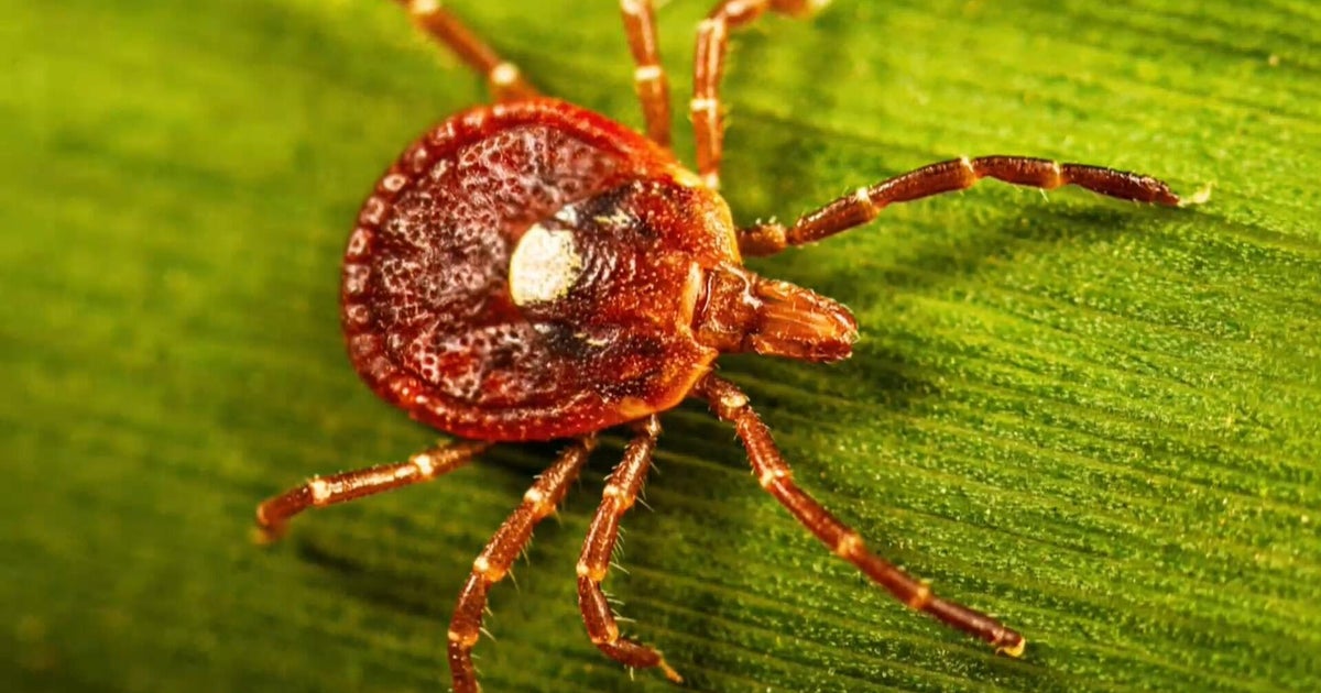 CBS News image for Tick season is expected to be worse than normal as ER visits rise in much of the U.S. - CBS News