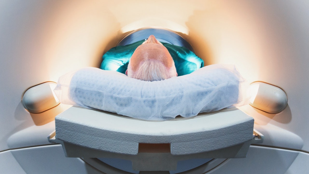 Fox News image for Major brain changes that occur around age 50 could impact dementia risk - Fox News