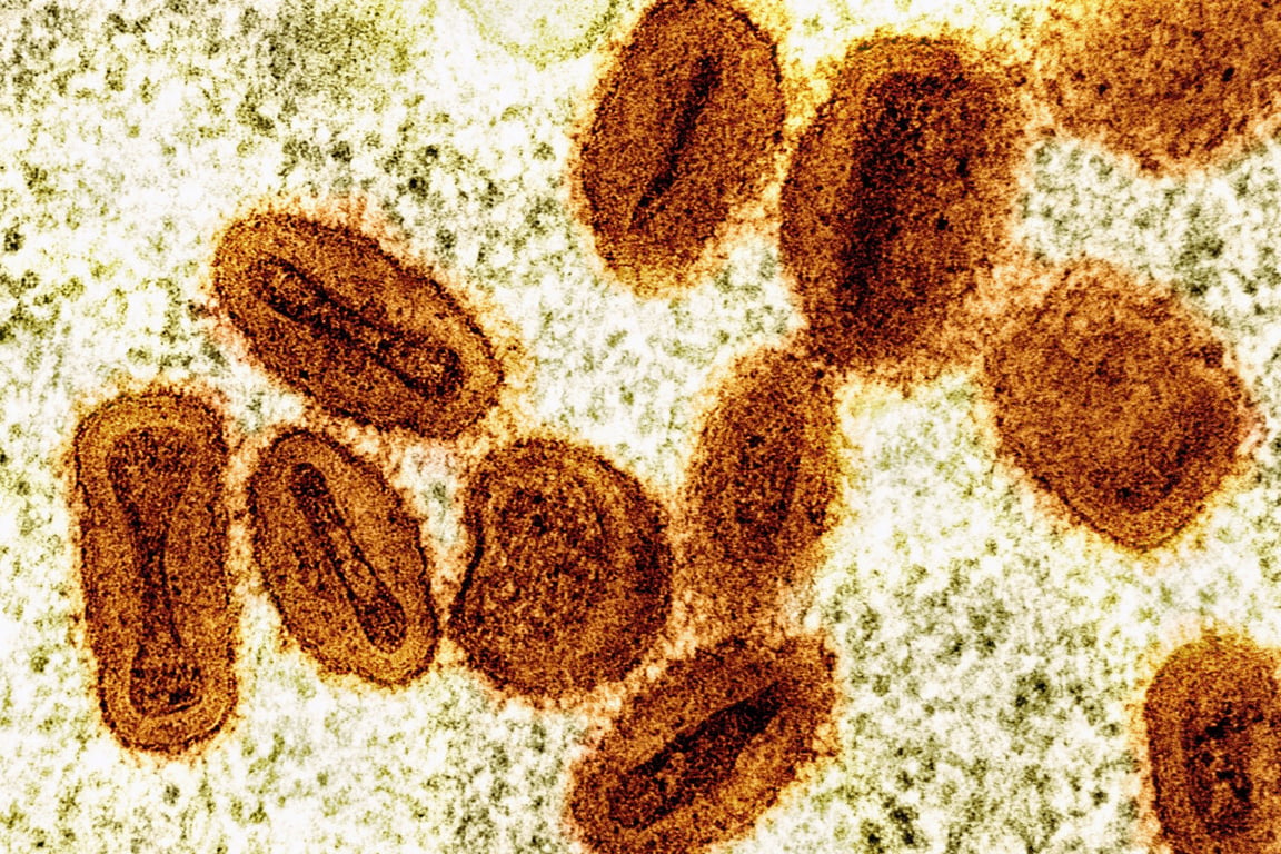 Politico image for 2 researchers charged with smuggling mpox into the US - Politico