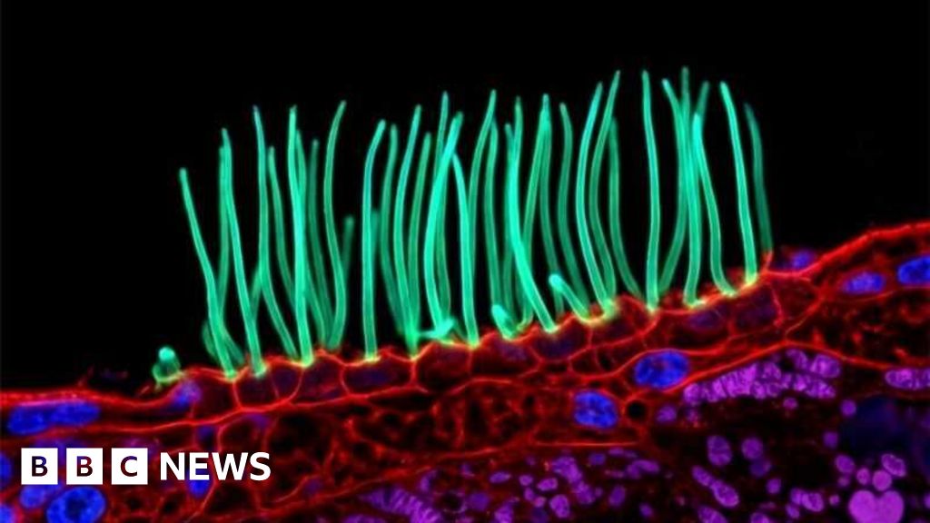 BBC News image for Tiny image sparks big backlash in Nikon photo contest - BBC