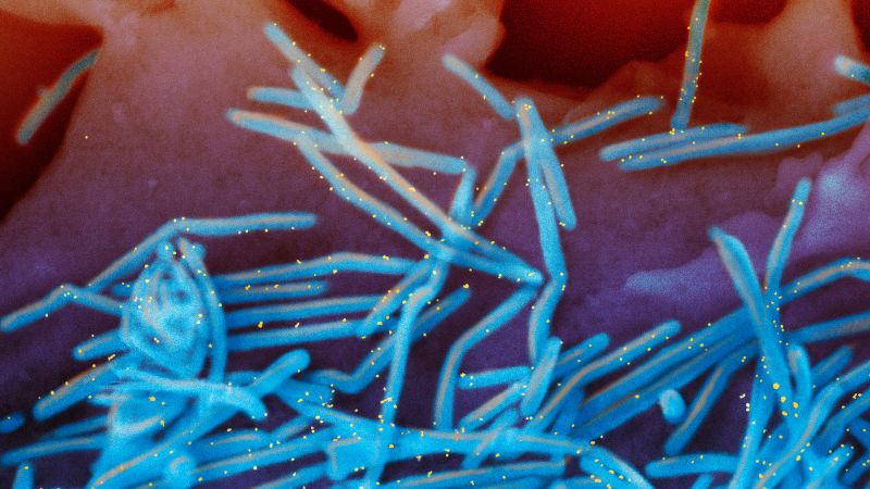 CNN image for RSV is still spreading, prompting states to extend the immunization period - CNN