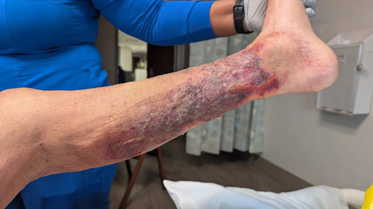 USA Today image for First flesh-eating bacteria death of 2026 recorded in this state - Yahoo News UK