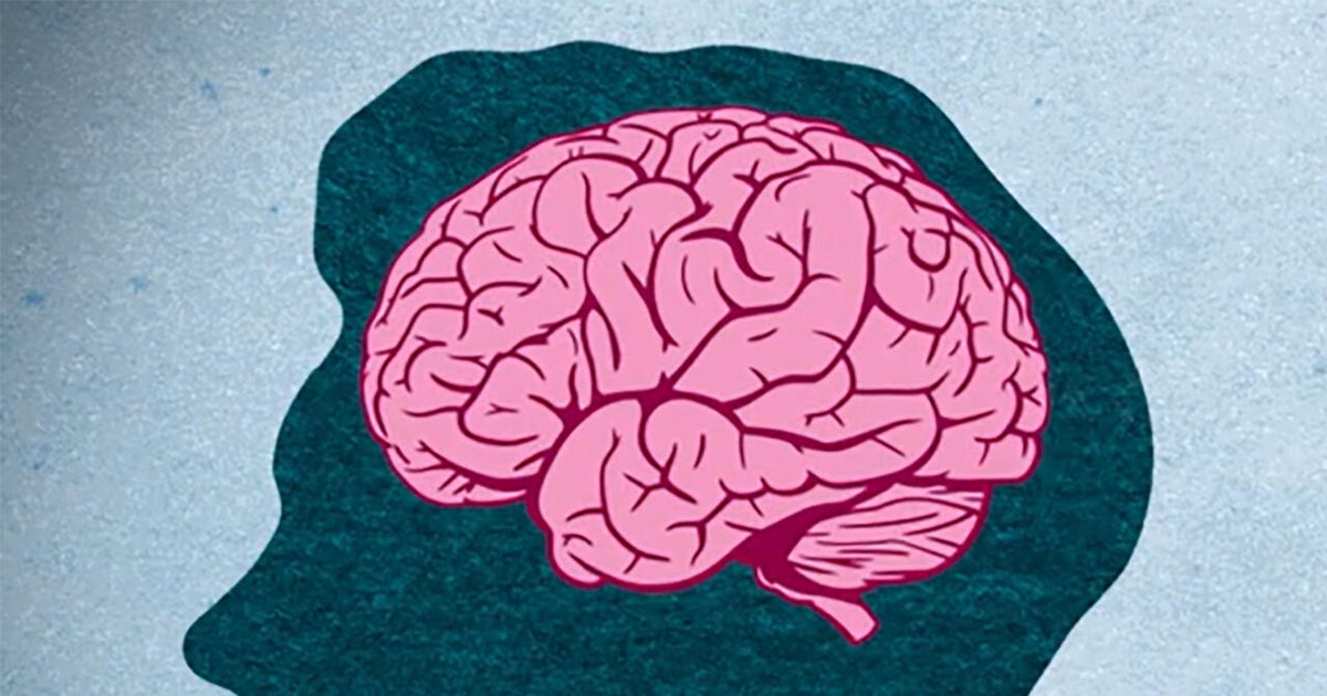 CBS News image for A tool to help keep dementia in check - CBS News