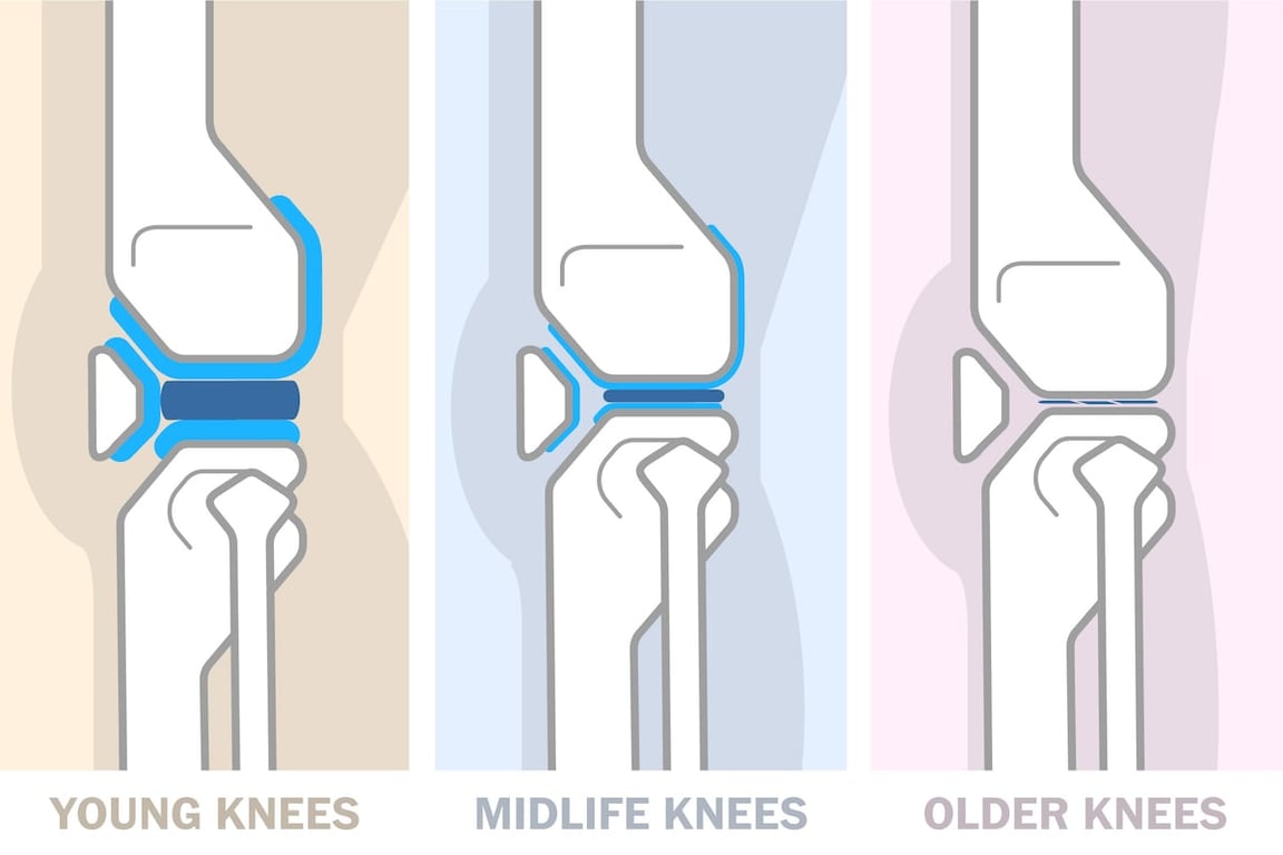 The Washington Post image for How to take care of your knees in your 20s, 30s, 40s and beyond - The Washington Post