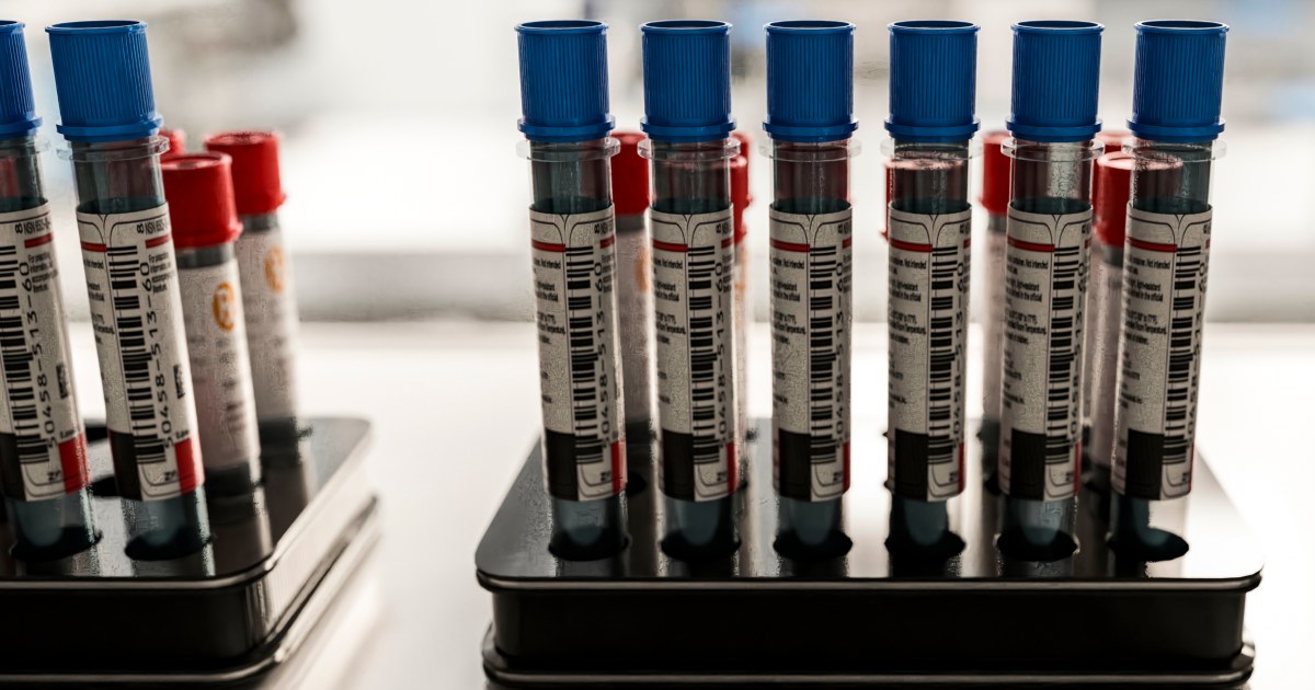 NBC News image for Patients say they want Alzheimer’s blood tests. Doctors aren’t sure they help. - NBC News