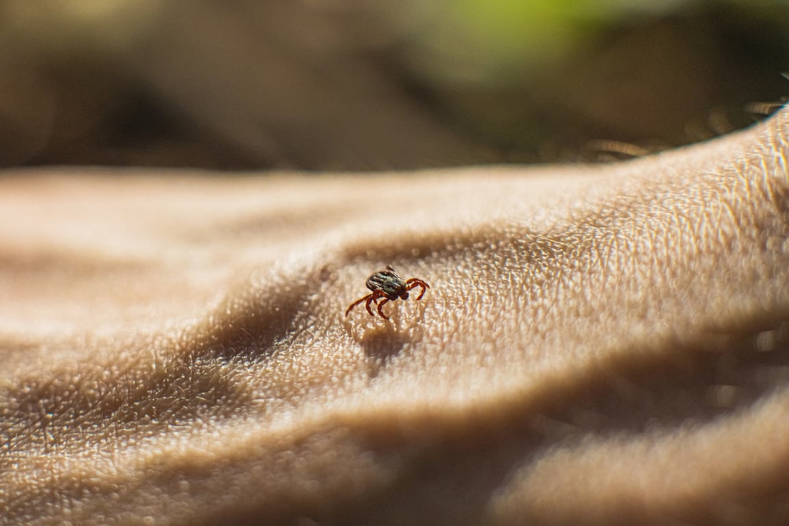 The Washington Post image for This rare tick-borne disease is on the rise in the U.S. - The Washington Post