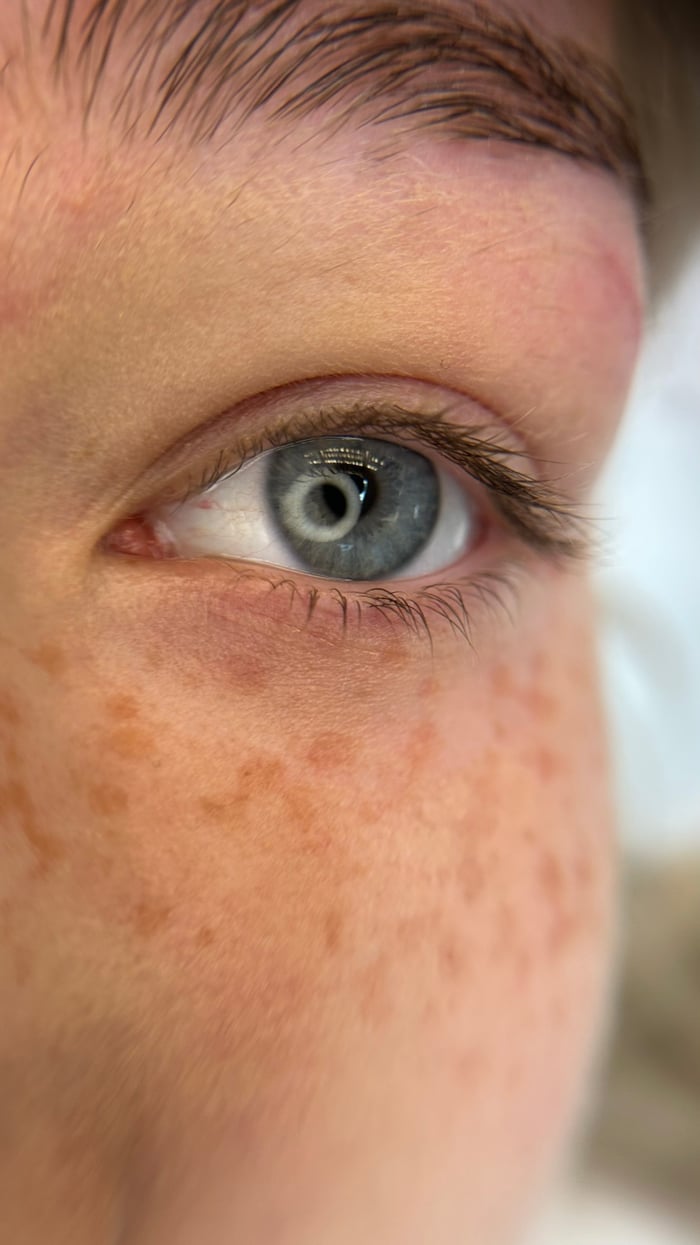 Nahaufnahme eines blauen Auges mit gelifteten Wimpern und Sommersprossen