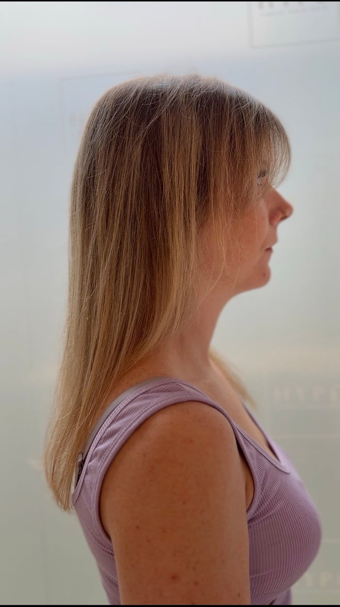 Feines, dünnes blondes Haar im Seitenprofil vor der Haarverlängerung