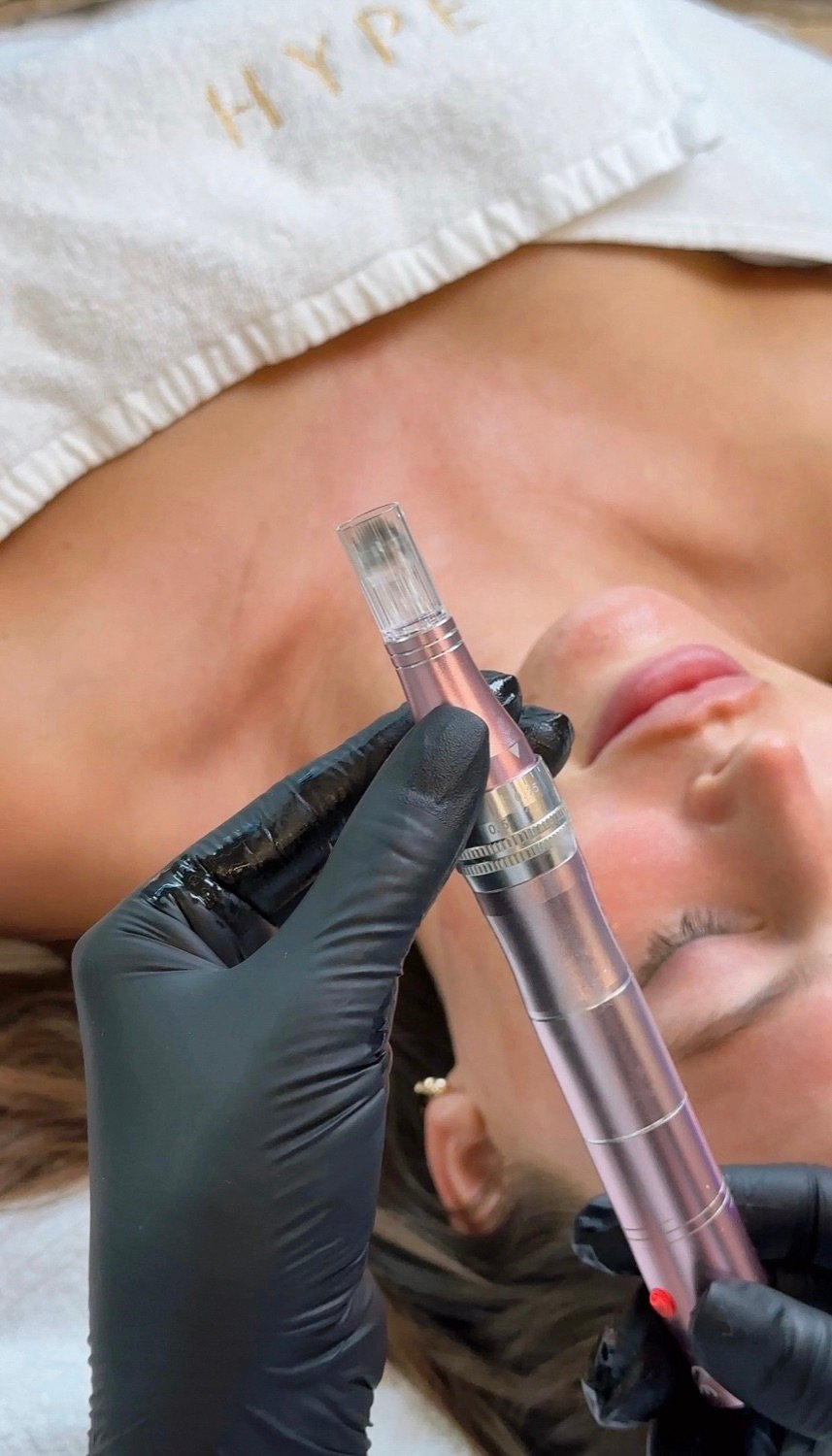 Kosmetikerin führt SkinPen Microneedling durch, HYPE-Handtuch im Hintergrund