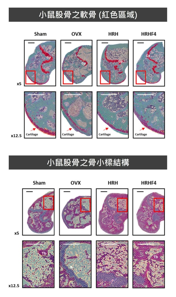 沙棘能夠恢復更年期骨質流失與骨骼結構