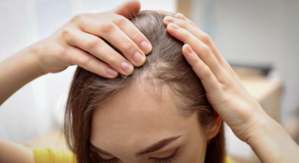 落髮（掉髮）不僅是男性困擾，在女性間也十分常見。其原因多半與遺傳、營養、壓力、環境刺激有關。