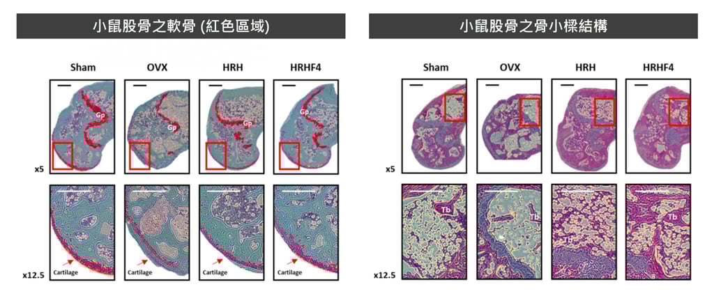 沙棘能夠恢復更年期骨質流失與骨骼結構
