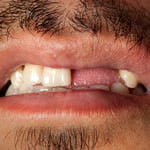 Científicos japoneses prueban un fármaco capaz de regenerar los dientes