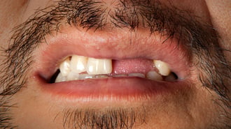 Científicos japoneses prueban un fármaco capaz de regenerar los dientes