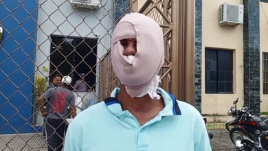 Por 200 pesos queman rostro a hombre con sancocho hirviendo en Santiago