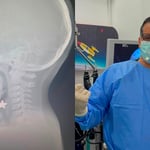 Los médicos explicaron que la aspiración de cuerpos extraños figura entre las emergencias respiratorias más delicadas en la población infantil, ya que puede comprometer la vida del paciente en cuestión de segundos si no recibe atención oportuna.