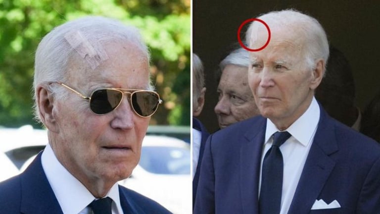 ¿Que le habrá pasado? Biden aparece con herida en la cabeza y genera preocupación