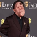 Actor con rara condición responde a repudiable twit tras ir a premios bafta 2025