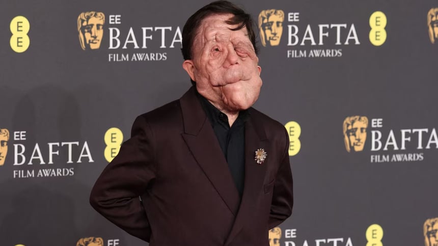 Actor con rara condición responde a repudiable twit tras ir a premios bafta 2025