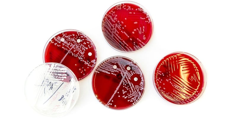 Algorithm for detection of microbial objects with more than 95% accuracy