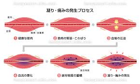 あまりに足腰が重くて・・・