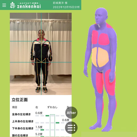 AI姿勢診断・骨盤調整