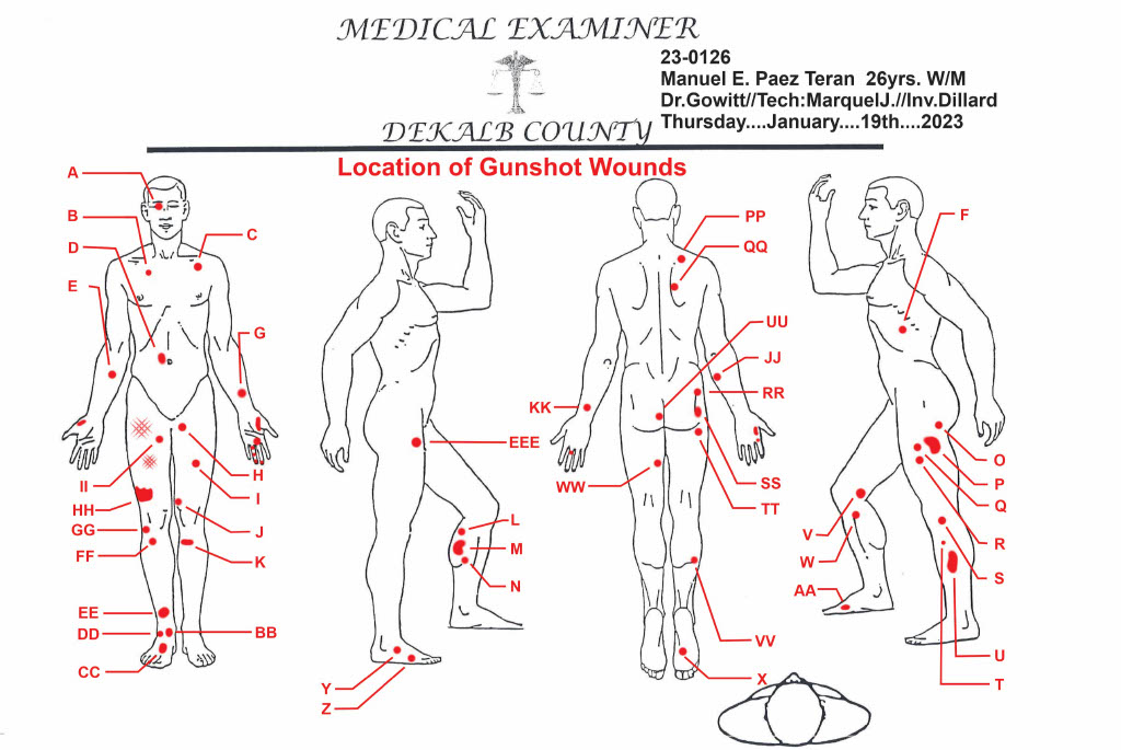 Diagram of gunshot wounds