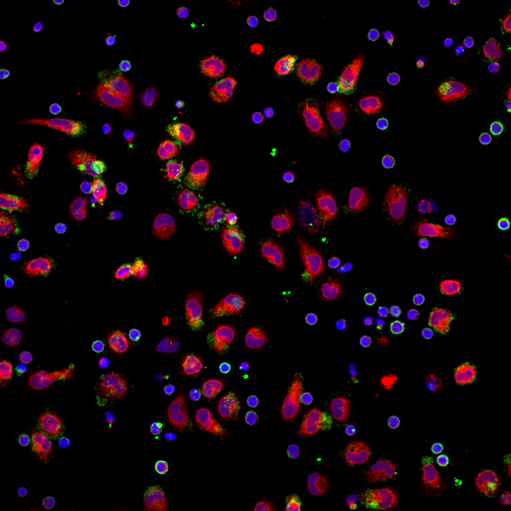 A field of view captured by a high-content microscope, highlighting the quantification of the Cell-to-cell feature in a control condition.