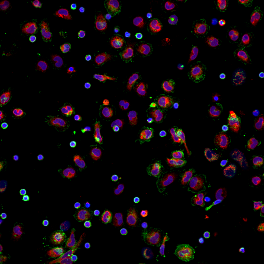 A field of view captured by a high-content microscope, highlighting the quantification of the Cell-to-cell feature in the Drug 093 condition.