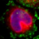 An individual cell identified within the broader field of view.