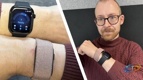Apple Watch Series 12 vs Garmin Cirqa: Which Sleep Tracker is More Reliable?