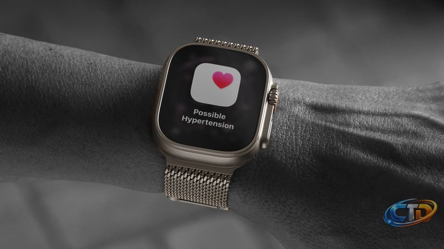 Enhance Your Apple Watch: 6 Affordable Accessories to Consider