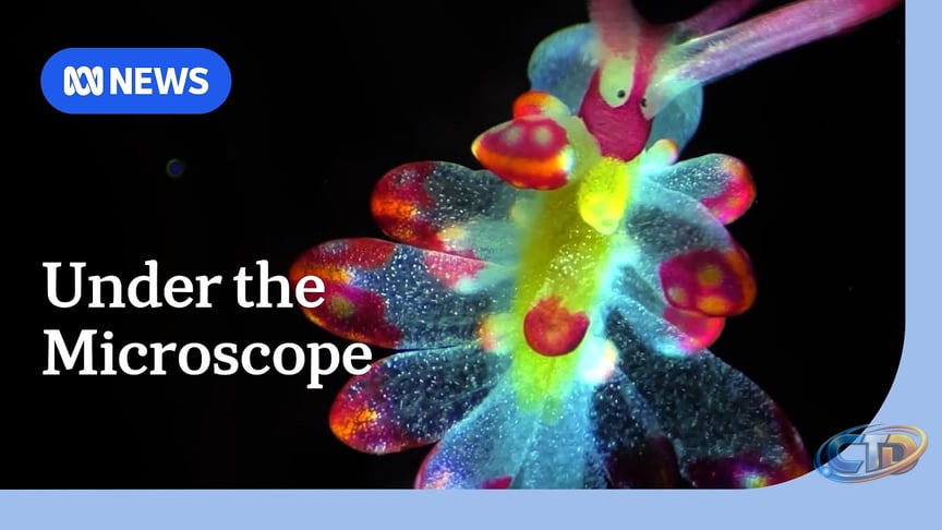 Microscopic wonders captured in Nikon Small World competition | ABC NEWS