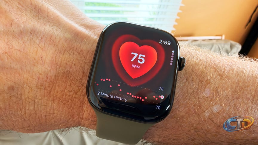 I've been wearing the Apple Watch Series 12 for 10 days, but I can't stop  thinking about one 'slightly off' reading | TechRadar