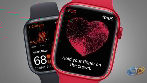 Study Shows Apple Watch Can Enhance Early Detection of Atrial Fibrillation