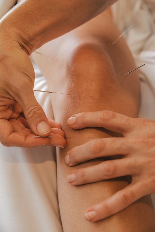 Acupuncture at Palomino Massage & Acupuncture in Marble Falls, Texas