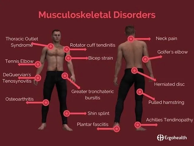 TechDogs-"Reducing Musculoskeletal Disorders (MSDs) And Other Injury Risks"-"Image Of Front And Back View Of A Male Figure Highlighting Various Musculoskeletal Disorder Points Across The Body"