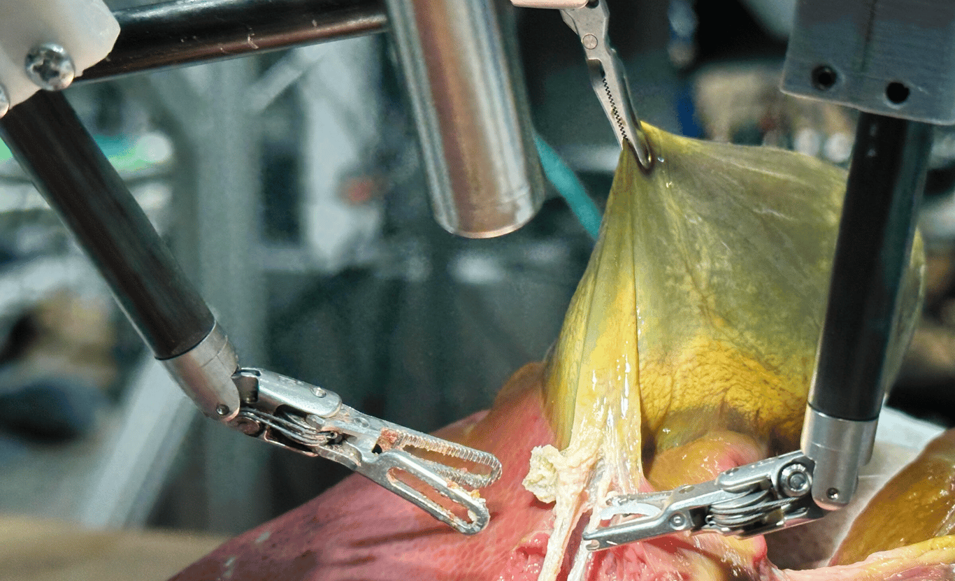 TechDogs-"Johns Hopkins' SRT-H Robot Performing A Gallbladder Surgery On Synthetic Tissue"